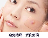微针美容