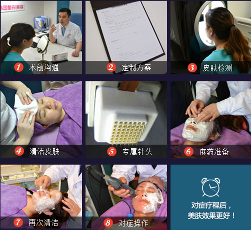 黄金微针