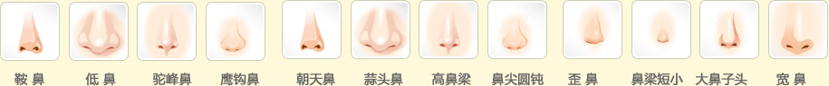 各种不完美鼻子形态