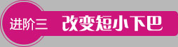 T区整形下巴