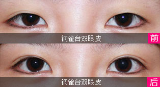 案例